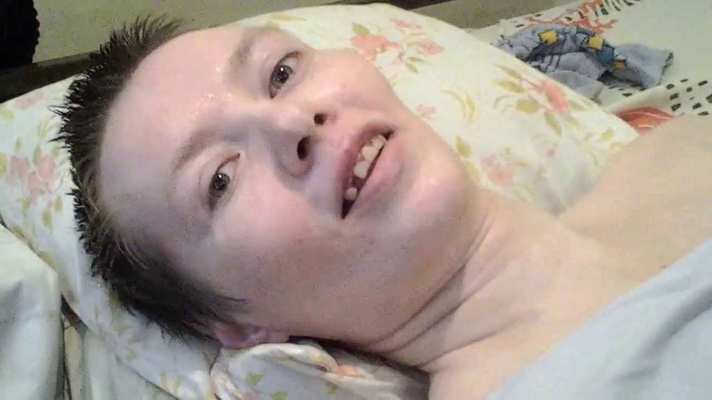 необратимые последствия употребления соли