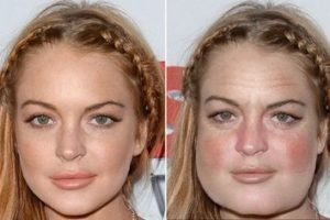 внешние признаки алкоголизма